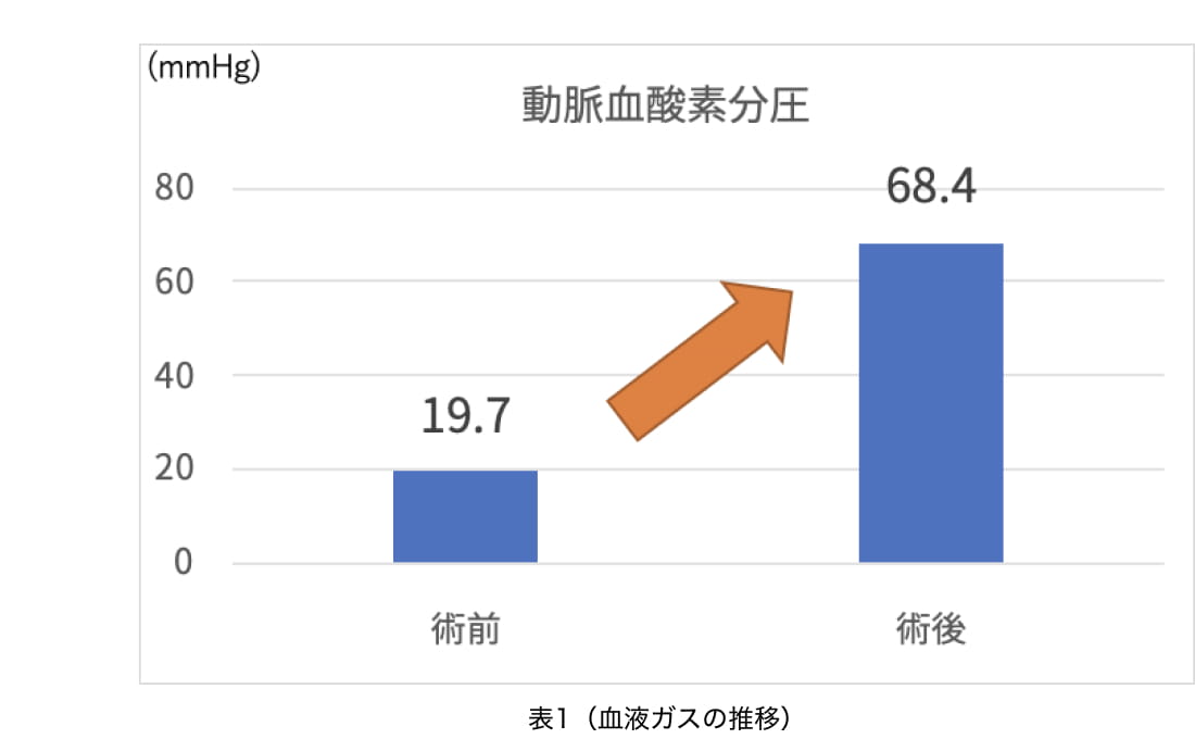 表1（血液ガスの推移）